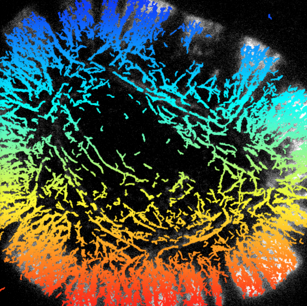 Myosin-6 tracks in lamellopodial actin